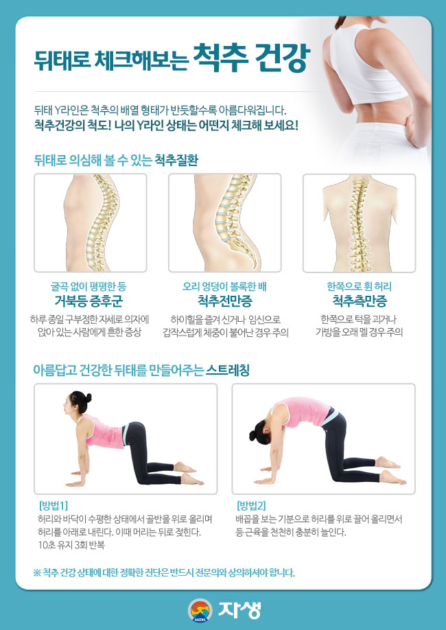 자생한방병원 건강정보 - 뒤태로 체크해보는 척추 건강. 아래내용 참조
