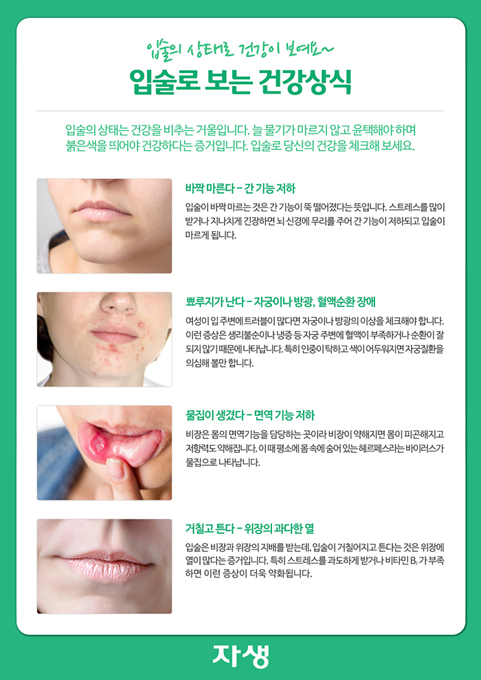 자생한방병원 건강정보 - 입술의 상태로 건강이 보여요~ 입술로 보는 건강상식