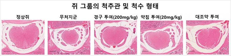 [사진설명] 정상군과 척추관협착증을 유도한 무처지군의 척추관 및 척수 형태가 확연히 다름을 알 수 있다. 신바로2를 투여한 쥐들의 척수는 정산군의 척추관과 척수의 형태도 구조적 회복을 한 모습을 확인할 수 있다. - 자생의료재단