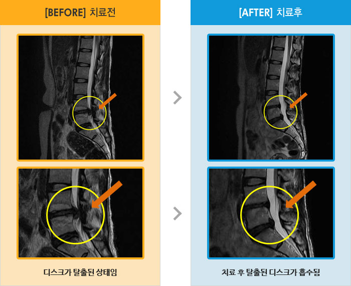 ڻѹ溴 ġ MRI  ġ- 㸮  㸮   ɾҴ Ͼ  