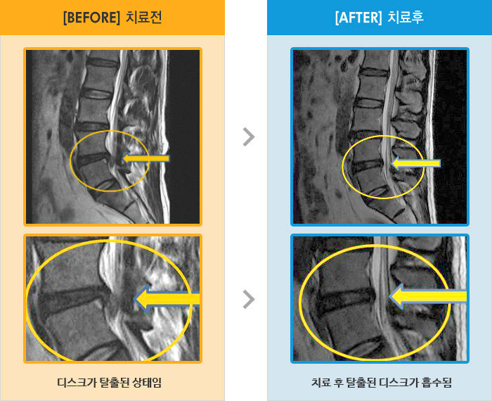 ڻѹ溴 ġ MRI  ġ-㸮 ,   