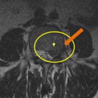 MRIġ���� �̹���