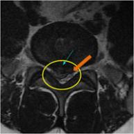 MRIġ���� �̹���