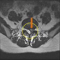 MRIġ���� �̹���