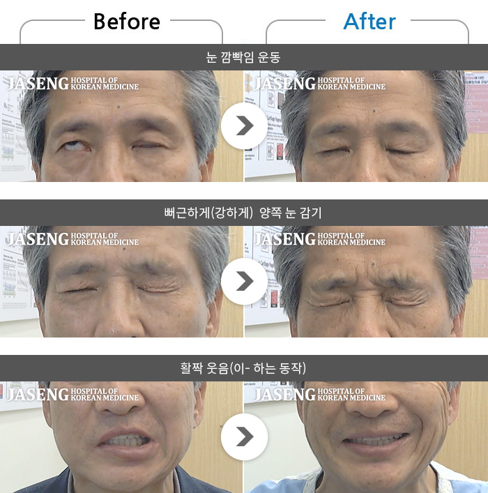 ڻѹ溴 ġ ȸŰ渶 ġ-߱ ٹ ȸ鸶 ߻ ʱ, ߱ ġ  