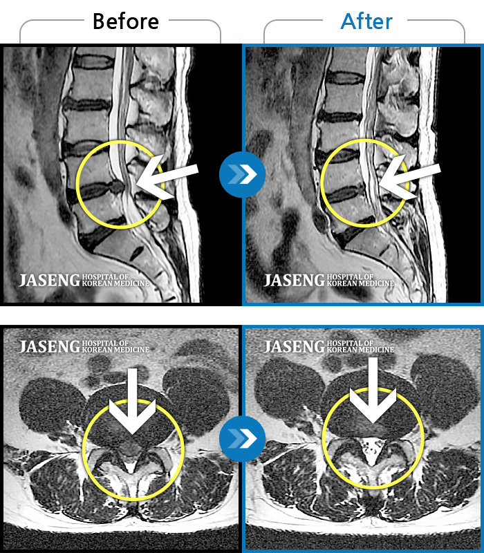 Ȼڻѹ溴 ġ MRI  ġ-㸮  ٸ ڷ Ǵ  ؽ ·  ȱ .