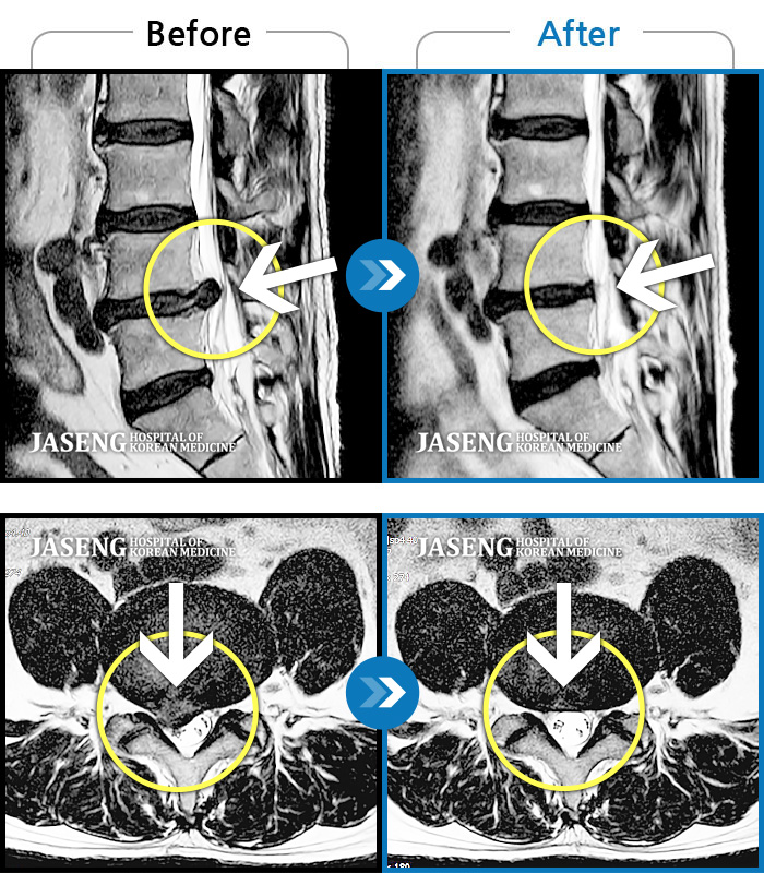 õڻѹ溴 ġ MRI  ġ-㸮    ڼ ,  ٸ   ´.