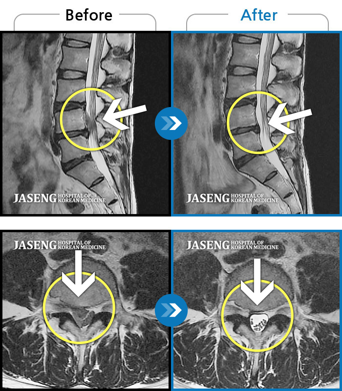 ڻѹ溴 ġ MRI  ġ-ó   㸮  ̺  Ƹ     ȣϼ̽ϴ.