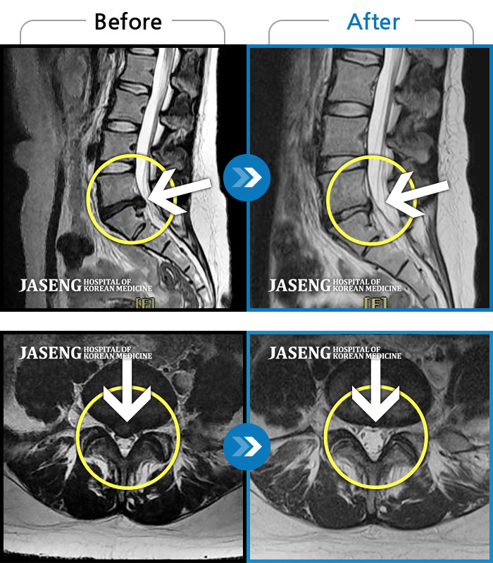 ڻѹ溴 ġ MRI  ġ- 㸮  ݱ ϰ  ,   ̾ 