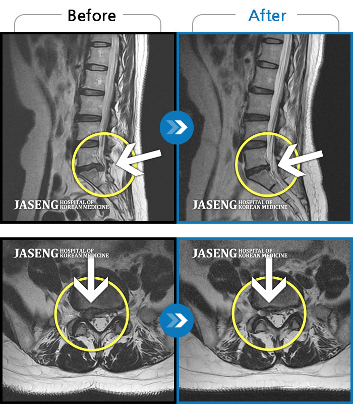 дڻѹ溴 ġ MRI  ġ-㸮  к    ĸ ؽ  ȣ