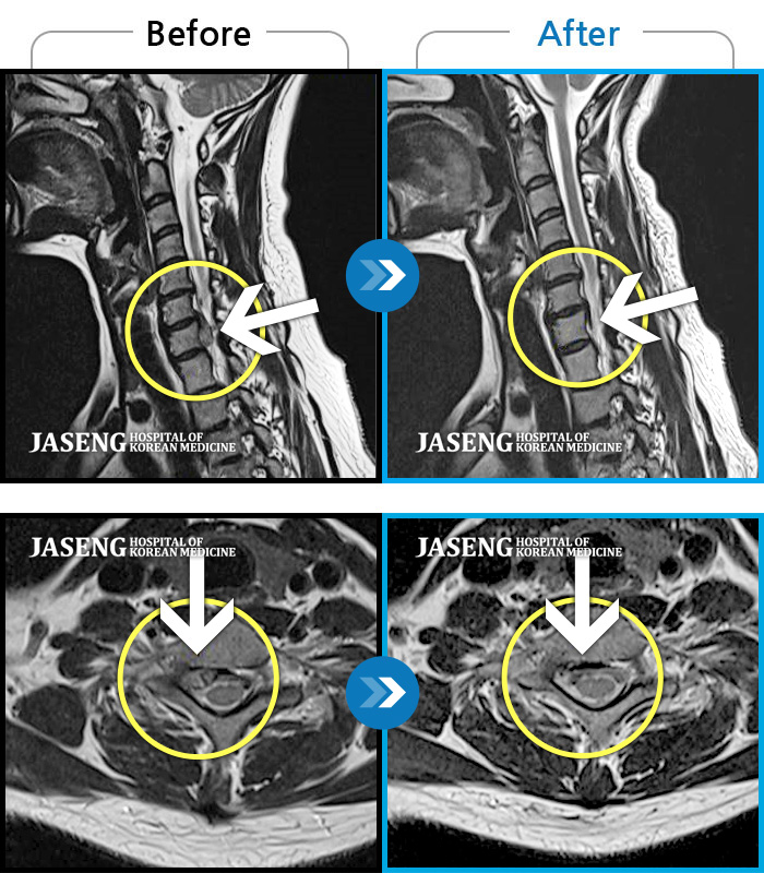 ڻѹ溴 ġ MRI  ġ- İκ ߰񳻿 ,  ȿ հ ̾ 