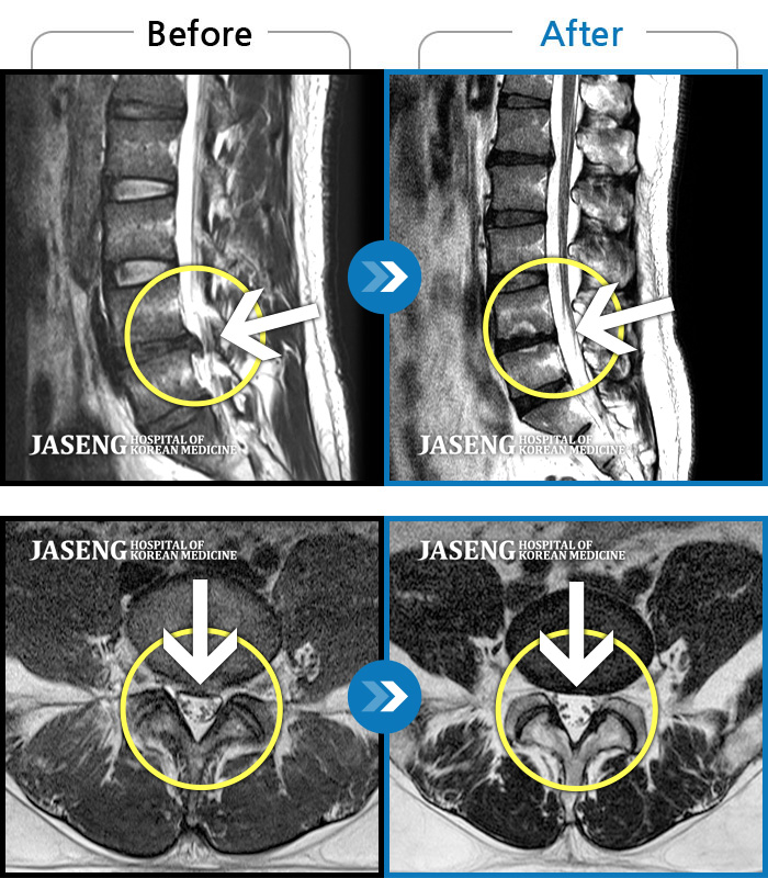 ϻڻѹ溴 ġ MRI  ġ- 㸮, , Ƹ  ߸, ߵ    ϻ Ȱ   ʷ