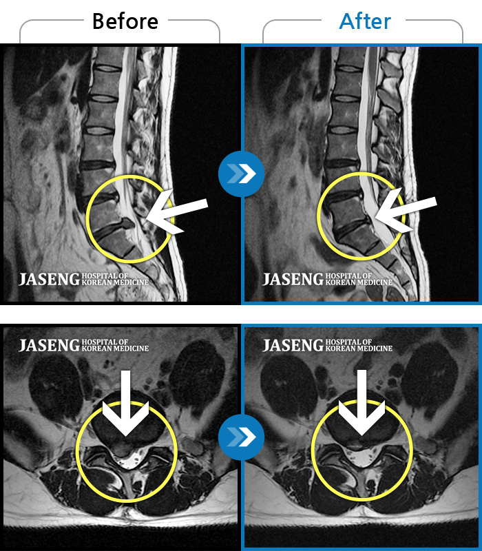 ȭڻѹ溴 ġ MRI  ġ-㸮  ٸ  ؼ ɰų ⵵ 