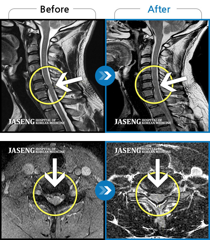 ϻڻѹ溴 ġ MRI  ġ- İ    