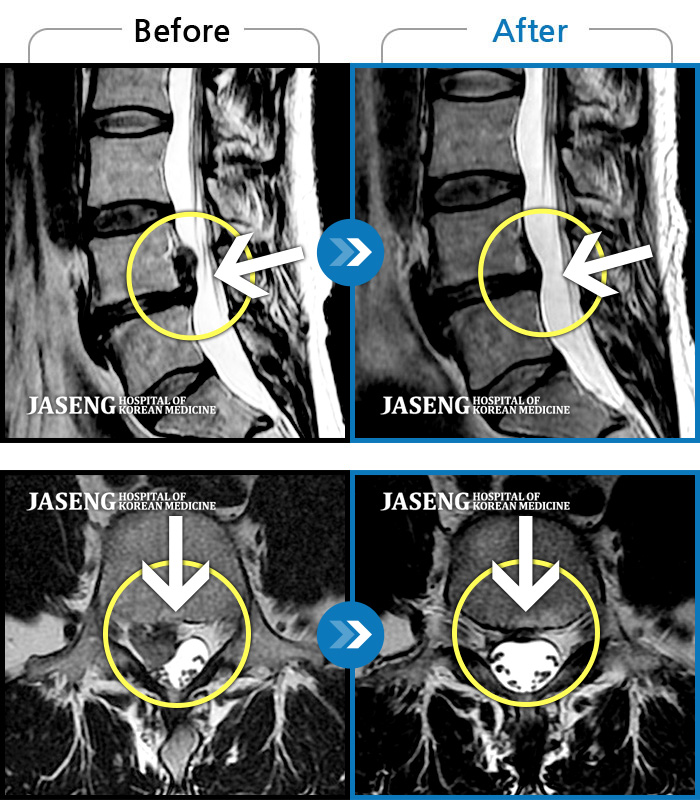 õڻѹ溴 ġ MRI  ġ-㸮̴    ްϰ ߻  , , ߰ ־.