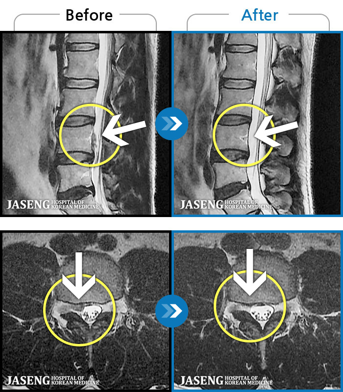 ڻѹ溴 ġ MRI  ġ- 㸮,     ٸ  ؽߴ.
