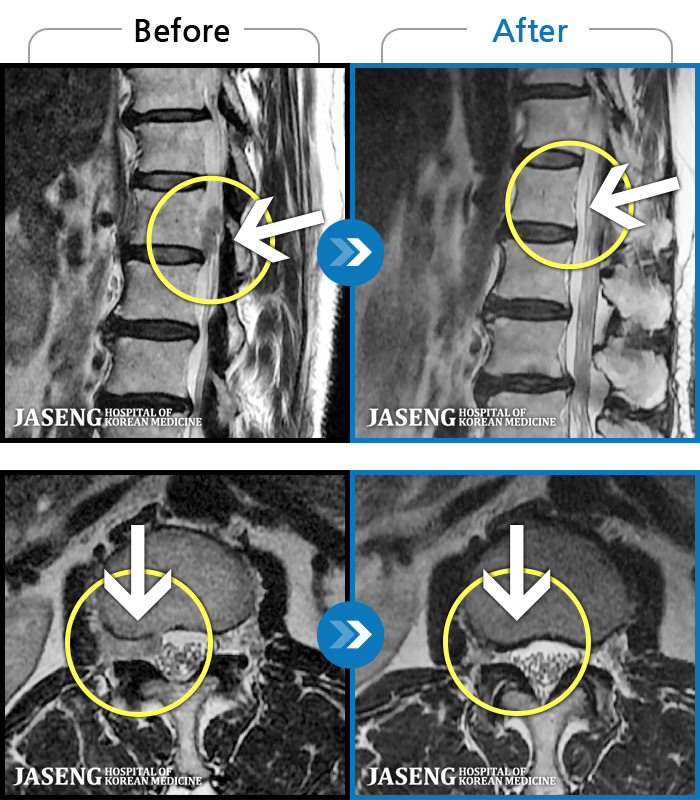 ڻѹ溴 ġ MRI  ġ-Ʒ 㸮  ݿ  ־ϴ.