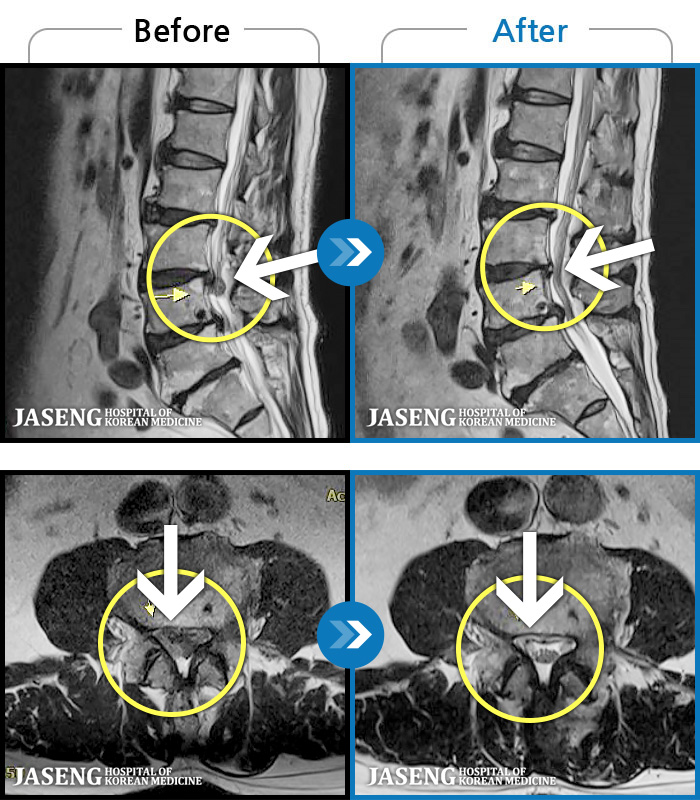 ڻѹ溴 ġ MRI  ġ- 㸮 ݱ  ,  ٸ  Ͽ ϼ̽ϴ.