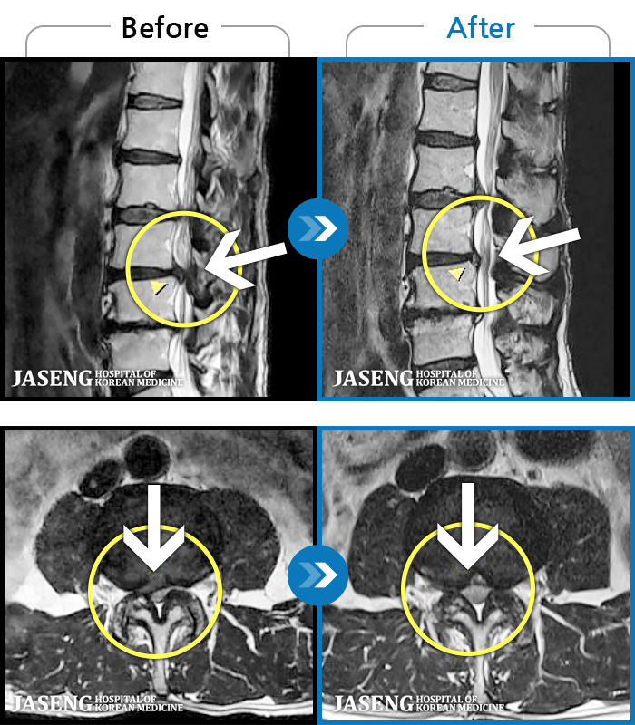 ڻѹ溴 ġ MRI  ġ- 㸮   ,  ٸ  ̾   ϼ̽ϴ.