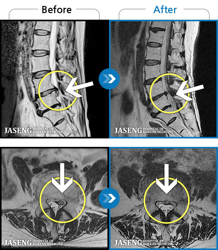 ڻѹ溴 ġ MRI ġ-㸮, ݺ ٸ ӵǰ ٸ