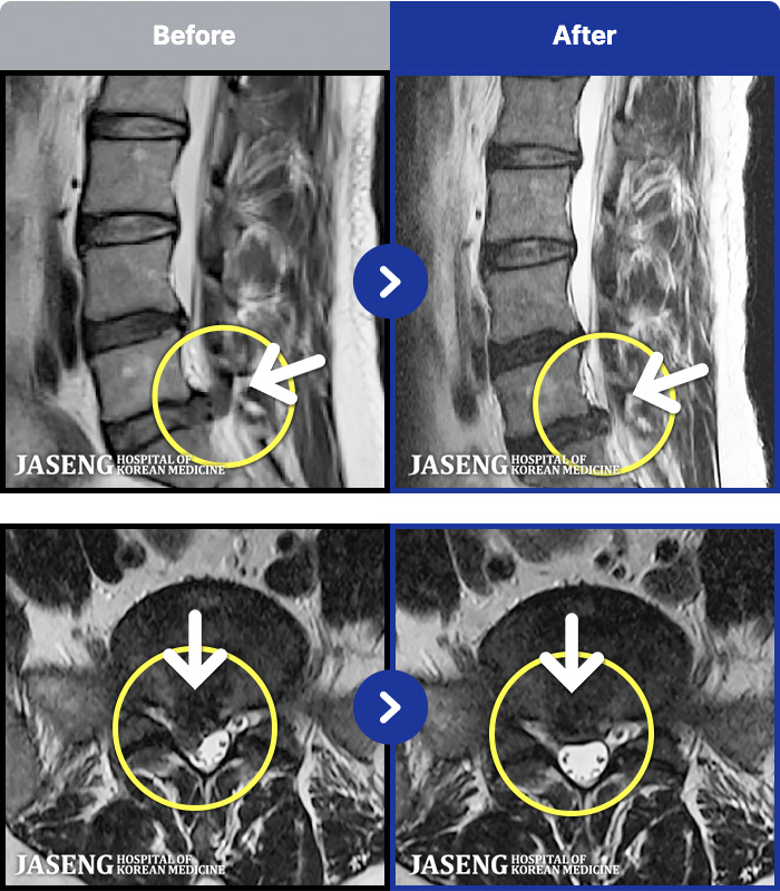 �ϻ��ڻ��ѹ溴�� ġ���� MRI�� ���� ġ����-���� ���� �� ���� �����ĸ�� �� ��ü�� ����, �ٷ�����