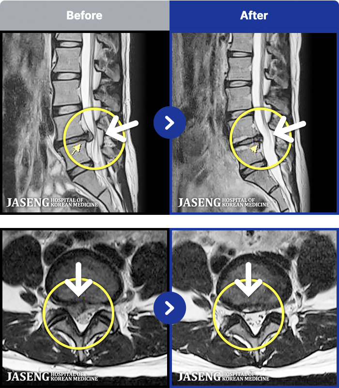 �ϻ��ڻ��ѹ溴�� ġ���� MRI�� ���� ġ����-�� 1�� ���� ���� �ʴ� ���� �㸮���� ���, ������������ �̾����� ���� �� �ɾҴ� �Ͼ �� ���� ��ȭ�Ǿ� �����ϼ̽��ϴ�.