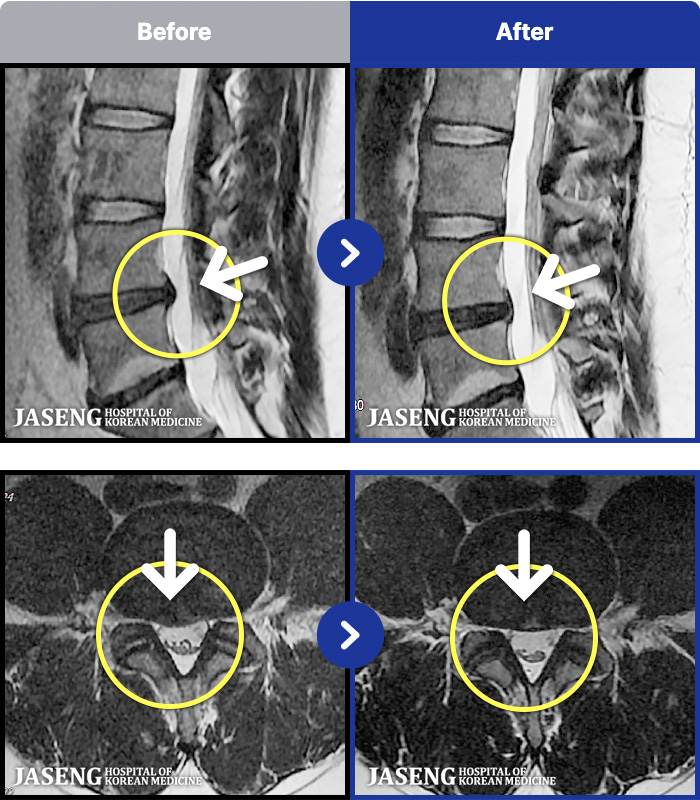 �ڻ��ѹ溴�� ġ���� MRI�� ���� ġ����-�������� ��� �㸮���� ��ħ�� �Ͼ�� �� ������ ���ؿ�.