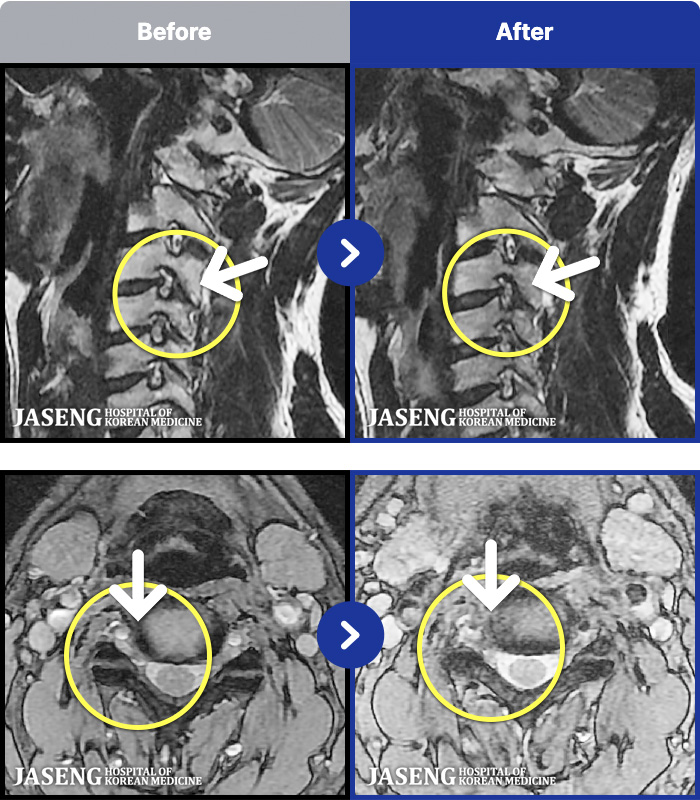 �ڻ��ѹ溴�� ġ���� MRI�� ���� ġ����-�ð��� ������ �������� �ʴ� �������� ����