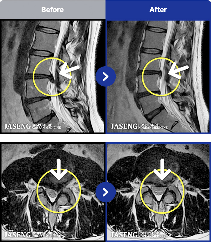 �ڻ��ѹ溴�� ġ���� MRI�� ���� ġ����-���� ���Ƹ��� ������ ���� �� �� �����.
