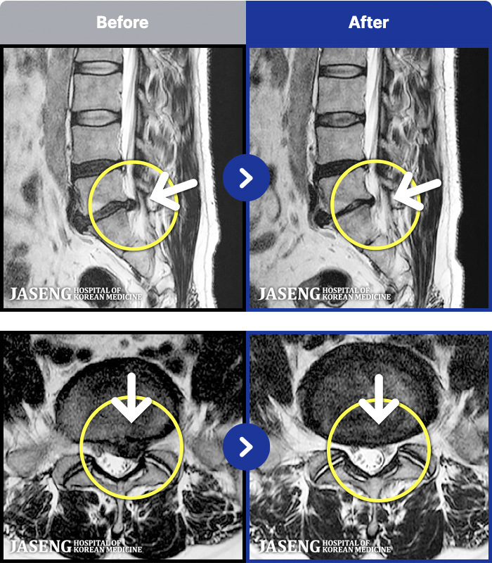 ڻѹ溴 ġ MRI ġ-㸮 ٸ ϰ ϻȰ Ұ߽ϴ.