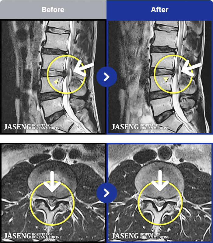õ���ڻ��ѹ溴�� ġ���� MRI�� ���� ġ����-�㸮���� ��� ����,  ���� �� ���� �ٸ� ������ ���� ��ȭ�Ǿ� �����ϼ̽��ϴ�.