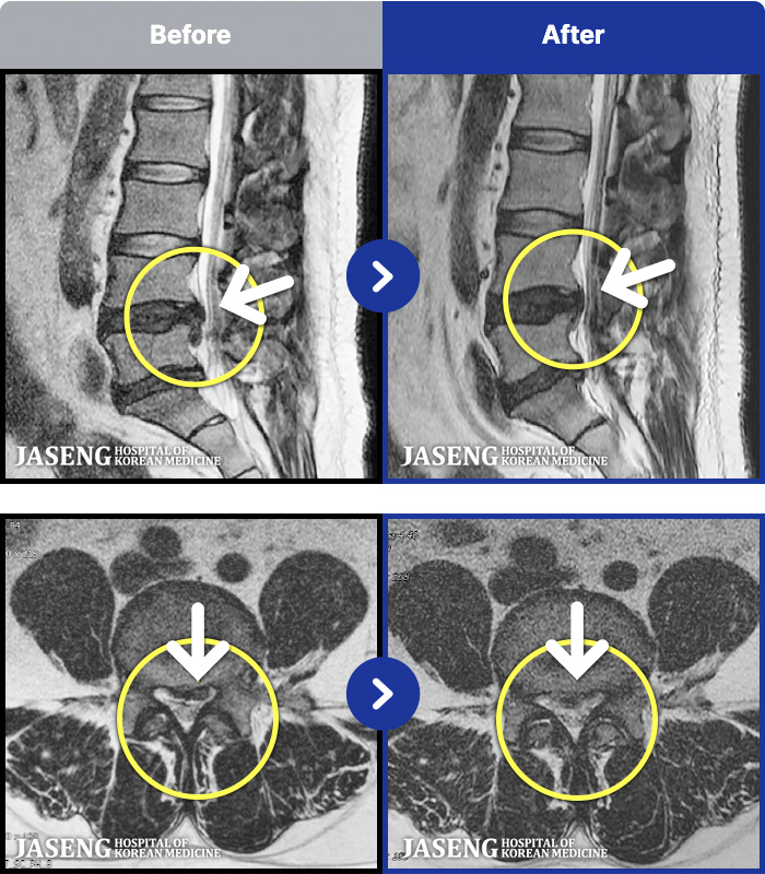 ڻѹ溴 ġ MRI ġ- ϰ ٸ ߰ ٷ Ϸ ϻȰ ¿ϴ.