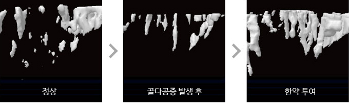 골소주 세포 재생 효과 시험 관련 이미지 입니다. 정상(좌측), 골다공증 발생후(가운데), 한약 투여(우측)