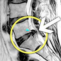 MRI ġ 
