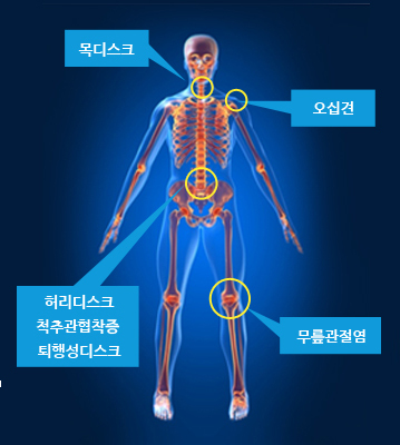 뱸ڻѹ溴-ũ,ʰ,㸮ũ,ô߰,༺ũ, ɸ   