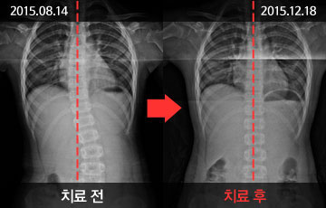 뱸ڻѹ溴 ûҳô ü&ô- ġ   ̹