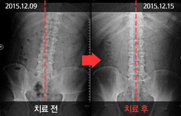 뱸ڻѹ溴 ûҳô ü&ô- ġ   ̹