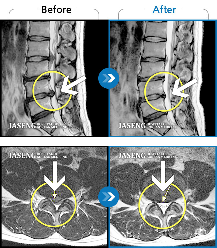 ڻѹ溴 ġ MRI ġ-㸮 , ٸ 