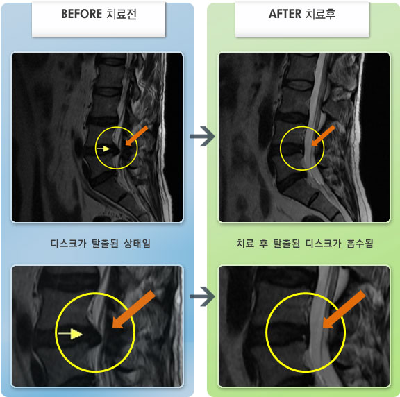 ڻѹ溴 ġ MRI ġ-㸮ũ 㸮 Ḳ
