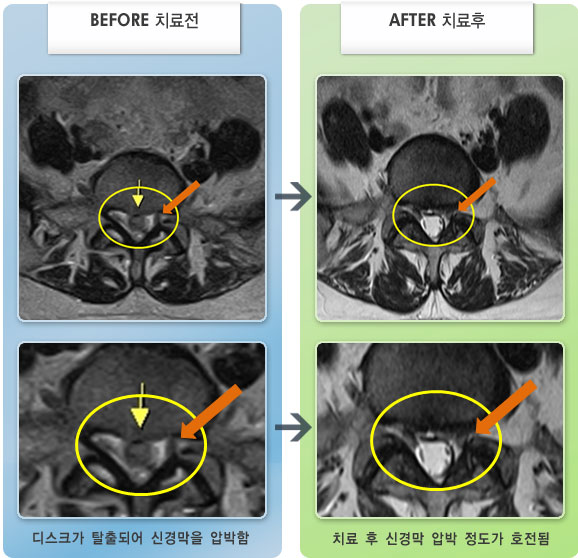âڻѹ溴 ġ MRI  ġ-㸮ũ   Ƹ