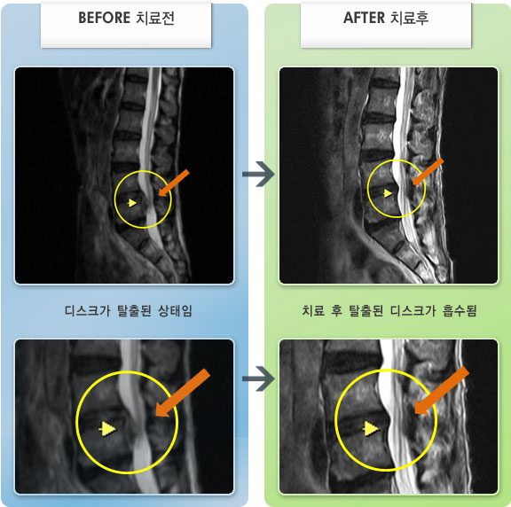 âڻѹ溴 ġ MRI  ġ-㸮ũ   ٸ 