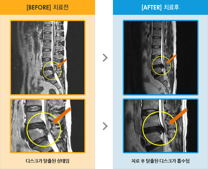 âڻѹ溴 ġ MRI  ġ-㸮  Ƹ  