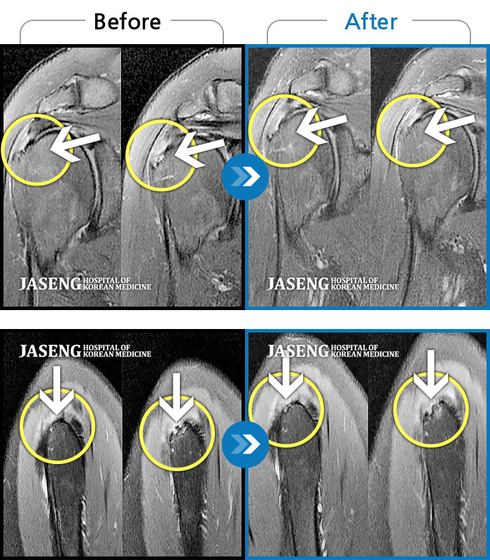 ڻѹ溴 ġ MRI ġ-Ѿ ¤鼭 ķ ϻȰ · Ͽϴ.