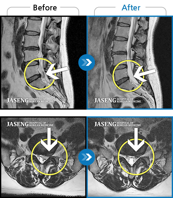 ڻѹ溴 ġ MRI ġ- Ƹ ҰŸ ߽ϴ.