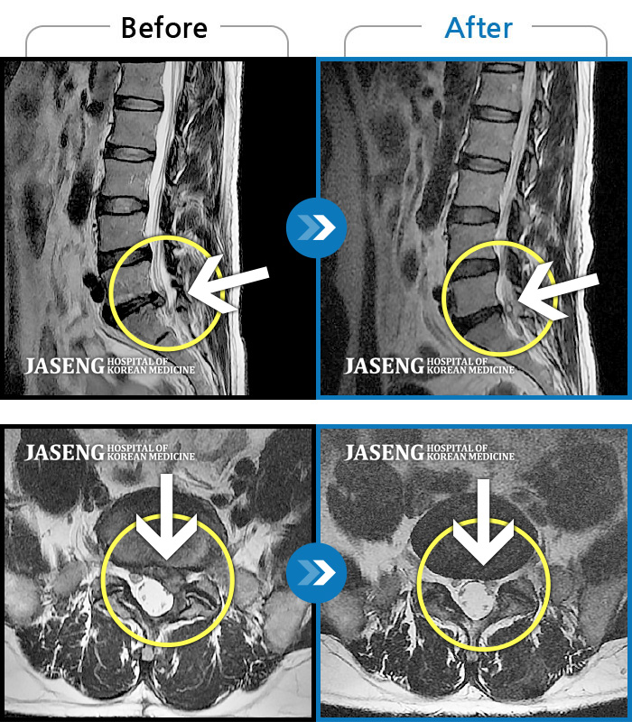 ϻڻѹ溴 ġ MRI  ġ-㸮,  ,  ٸ    ؼ  ϻȰ