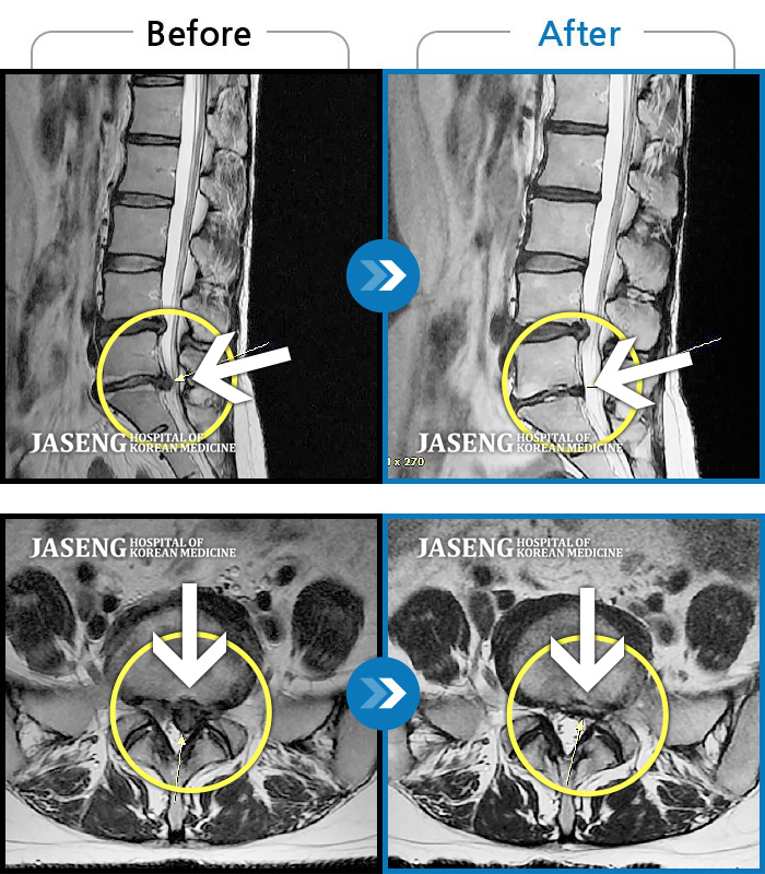 ڻѹ溴 ġ MRI  ġ- Ͽߺ