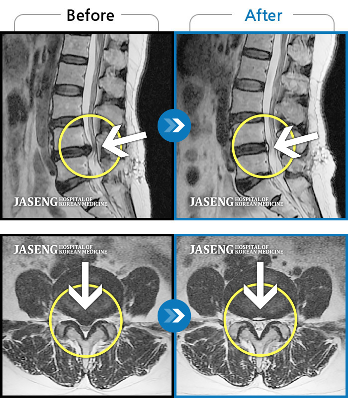 Ȼڻѹ溴 ġ MRI ġ-㸮 ٸ ݸ ɾ ɾƾ ߽ϴ.