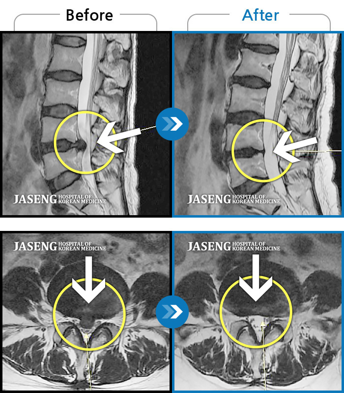 ڻѹ溴 ġ MRI  ġ- Ͽߺ