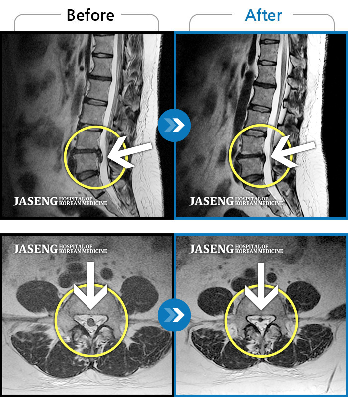 ڻѹ溴 ġ MRI ġ-㸮 ̱ ٸ Ϳ