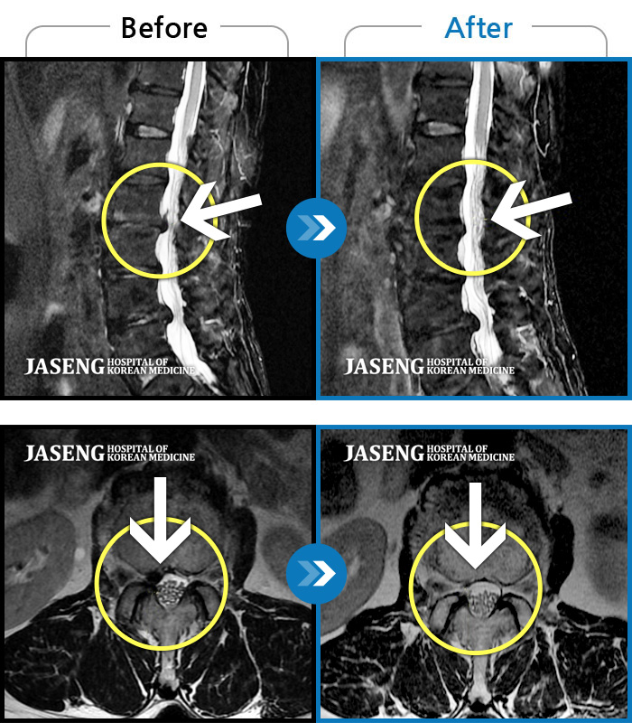 ڻѹ溴 ġ MRI  ġ-Ͽߺ